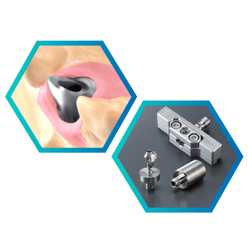 Abutment Kit (AK-1) Mill Custom Titanium Abutments